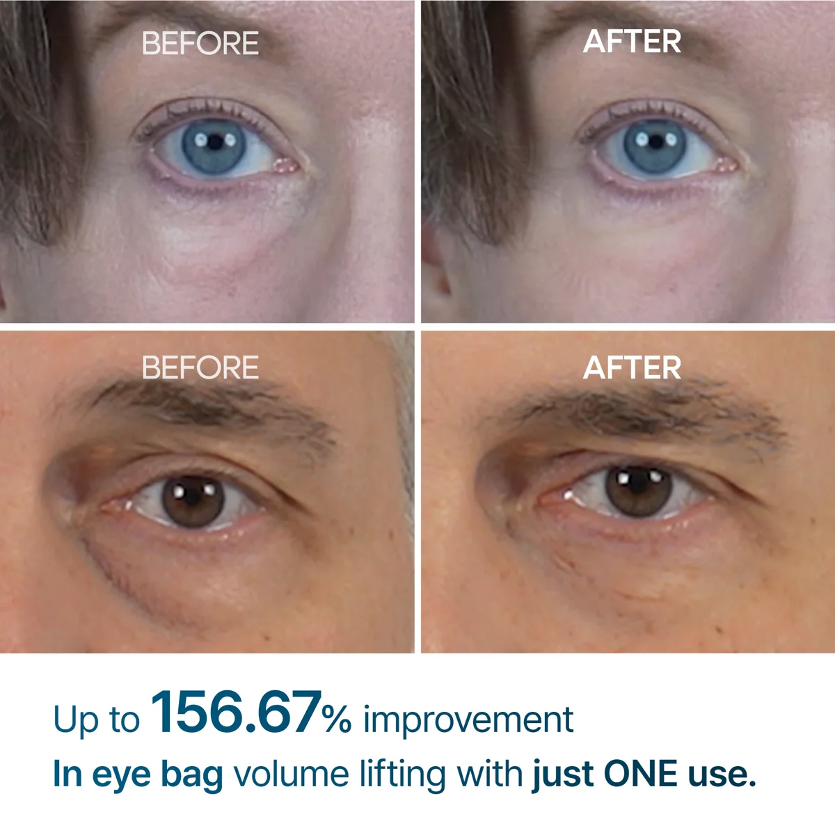 Dr. Melaxin Eyephalt Retinol Eyebag Cream 10 g